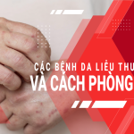 Các bệnh da liễu thường gặp và cách phòng tránh