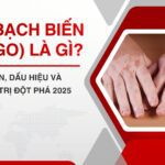 Bệnh Bạch biến (Vitiligo) là gì? Nguyên nhân, Dấu hiệu và 5 Cách điều trị đột phá 2025