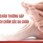 Vấn đề về chân thường gặp và cách chăm sóc da chân