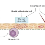 Ruxolitinib: niềm hi vọng mới cho bệnh nhân bạch biến