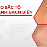 TẾ BÀO SẮC TỐ VÀ BỆNH BẠCH BIẾN