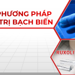 Các phương pháp điều trị bạch biến hiện nay