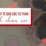 Điều Trị Cấy Tế Bào Gốc Tự Thân – Lưu ý và cách chăm sóc