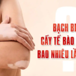 GHÉP DA ĐIỀU TRỊ BẠCH BIẾN