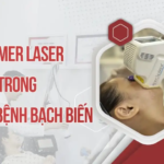 EXCIMER LASER TRONG ĐIỀU TRỊ BỆNH BẠCH BIẾN