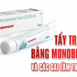 Tẩy trắng da bằng monobenzone