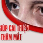 11 cách giúp cải thiện quầng thâm mắt