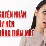 9 NGUYÊN NHÂN GÂY THÂM QUẦNG MẮT