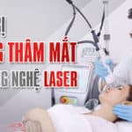 Điều trị quầng thâm mắt với công nghệ LASER