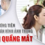 Các phương tiện chẩn đoán hình ảnh trong Thâm quầng mắt