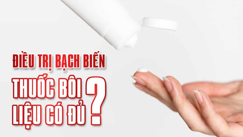 Điều trị bạch biến: Thuốc bôi liệu có đủ? [Phân tích & Giải pháp Hiệu Quả 2025]