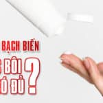 Điều trị bạch biến: THUỐC BÔI LIỆU CÓ ĐỦ