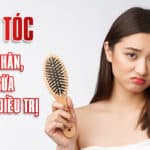 Rụng tóc: nguyên nhân, phòng ngừa và cách điều trị