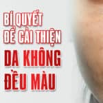 Da không đều màu – 5 bí quyết để cải thiện