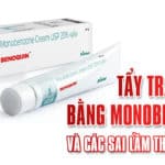 Tẩy trắng da bằng Monobenzone và các sai lầm thường gặp