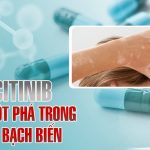 Ritlecitinib: bước đột phá trong điều trị bạch biến