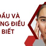 Da dầu và những điều cần biết