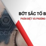 Bớt Sắc Tố Bẩm Sinh: Phân biệt và Phương Pháp Điều Trị