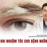 CẢNH BÁO TỪ CHUYÊN GIA: CẨN TRỌNG KHI NHUỘM TÓC CHO BỆNH NHÂN BẠCH BIẾN