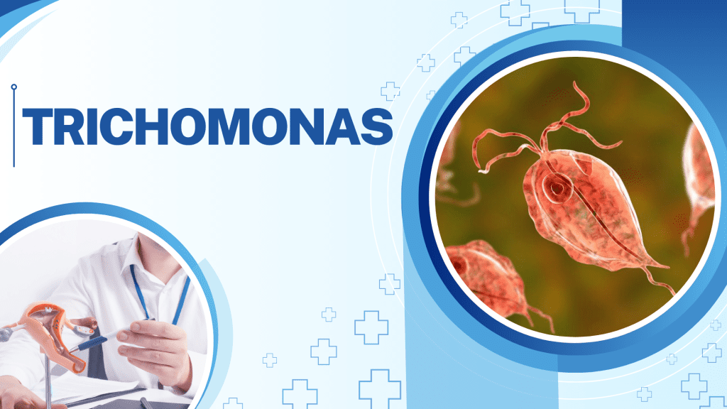 TRICHOMONAS