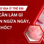 Viêm Da Cơ Địa Ở Trẻ Em: Ba Mẹ Cần Làm Gì Khi Con Ngứa Ngáy, Quấy Khóc?
