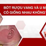 Bớt rượu vang và U mạch máu có giống nhau không? Cách phân biệt và điều trị hiệu quả tại Medcare