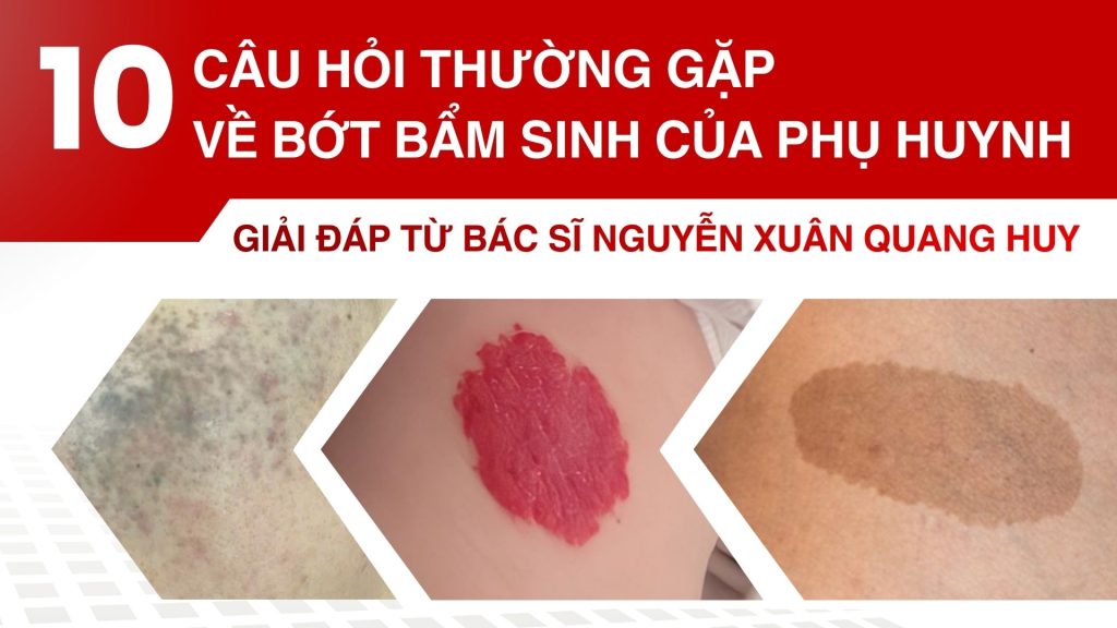 10 câu hỏi thường gặp về bớt bẩm sinh của phụ huynh – Giải đáp từ bác sĩ Nguyễn Xuân Quang Huy