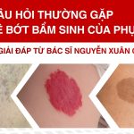 10 câu hỏi thường gặp về bớt bẩm sinh của phụ huynh – Giải đáp từ bác sĩ Nguyễn Xuân Quang Huy