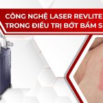 Công nghệ laser Revlite trong điều trị bớt bẩm sinh