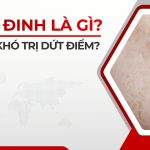 Nám đinh (nám chân sâu) là gì? Vì sao khó trị dứt điểm