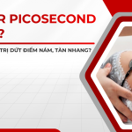Laser Picosecond là gì? Có thực sự trị dứt điểm nám, tàn nhang?